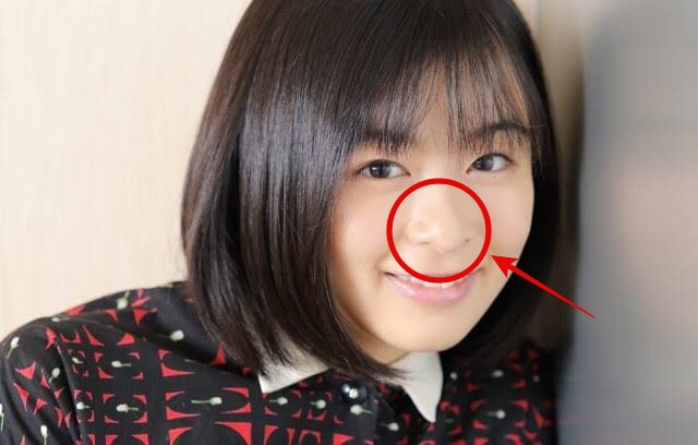 森七菜の鼻画像2