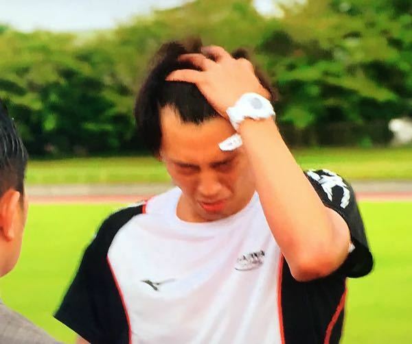 竹内涼真の生え際