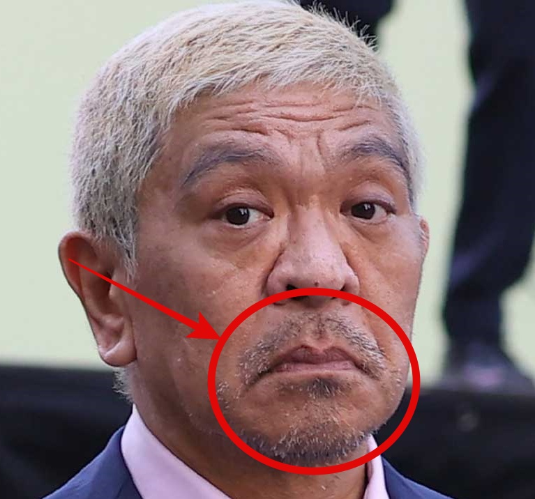 松本人志の口元