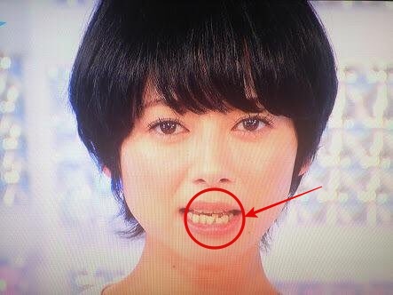 真木よう子の歯並び
