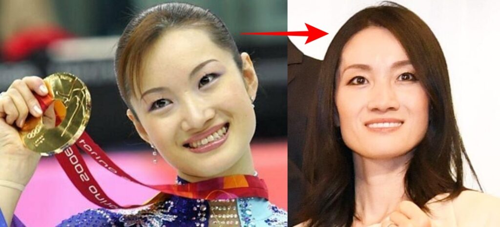 選手時代と引退後の荒川静香の比較画像