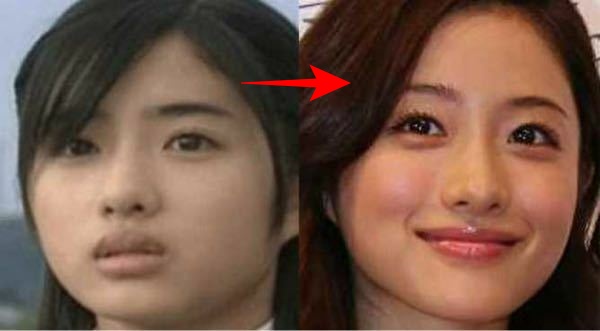 石原さとみの若い頃と現在
