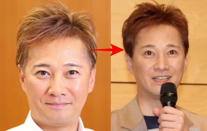 休業前と復帰後の中居正広