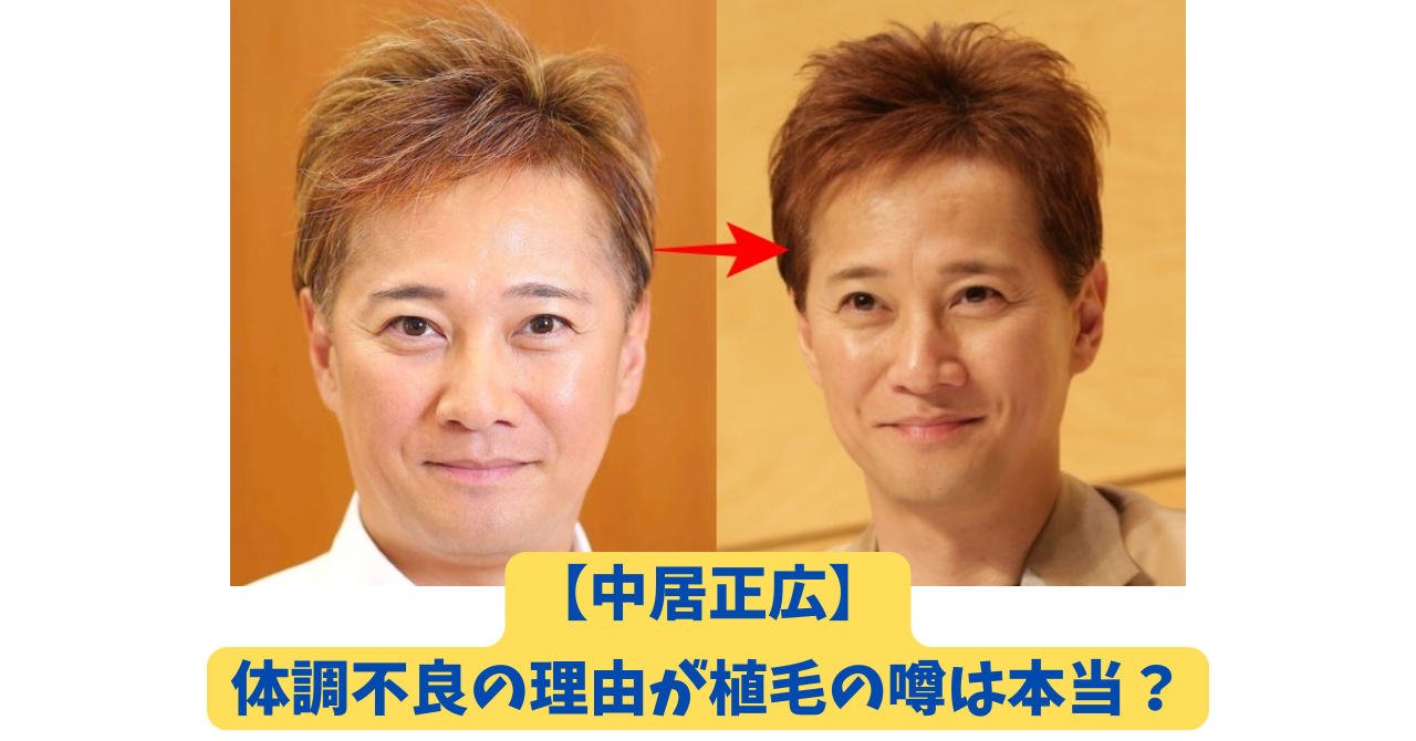 中居正広 アイキャッチ