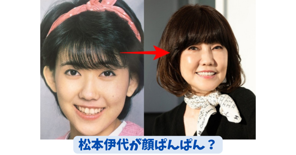 松本伊代　アイキャッチ