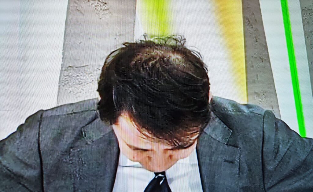 青井実薄毛画像1