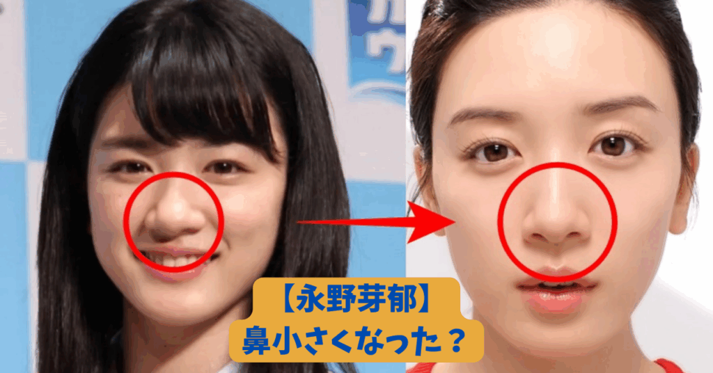 永野芽郁　鼻　アイキャッチ