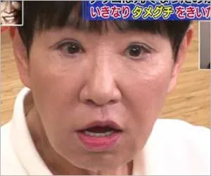 和田アキ子画像4