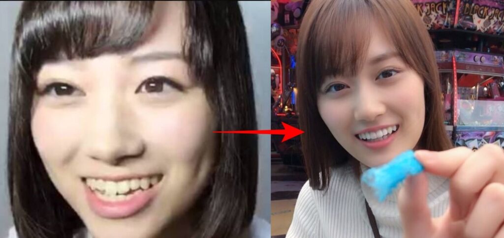 山下美月比較画像