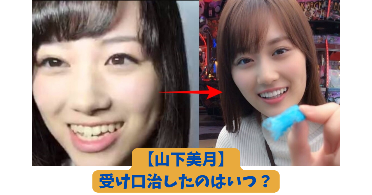 山下美月 アイキャッチ