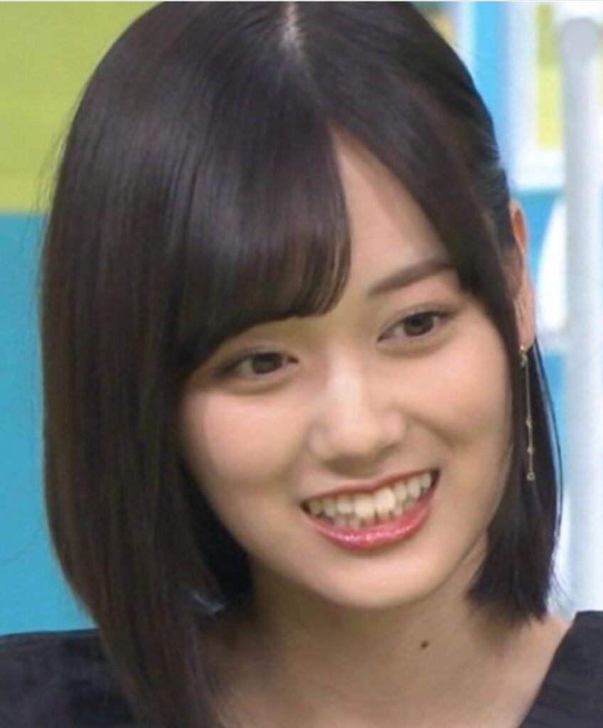 山下美月の歯並び画像1