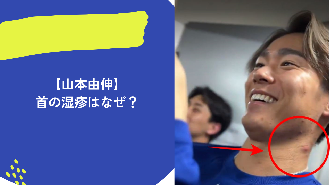 山本由伸 アイキャッチ