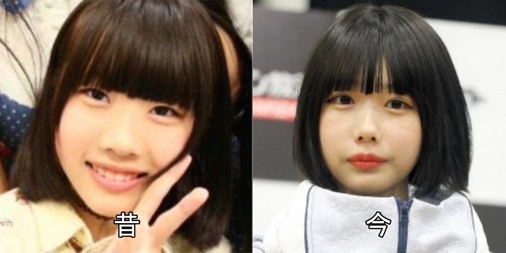 あのちゃん昔と今の画像比較