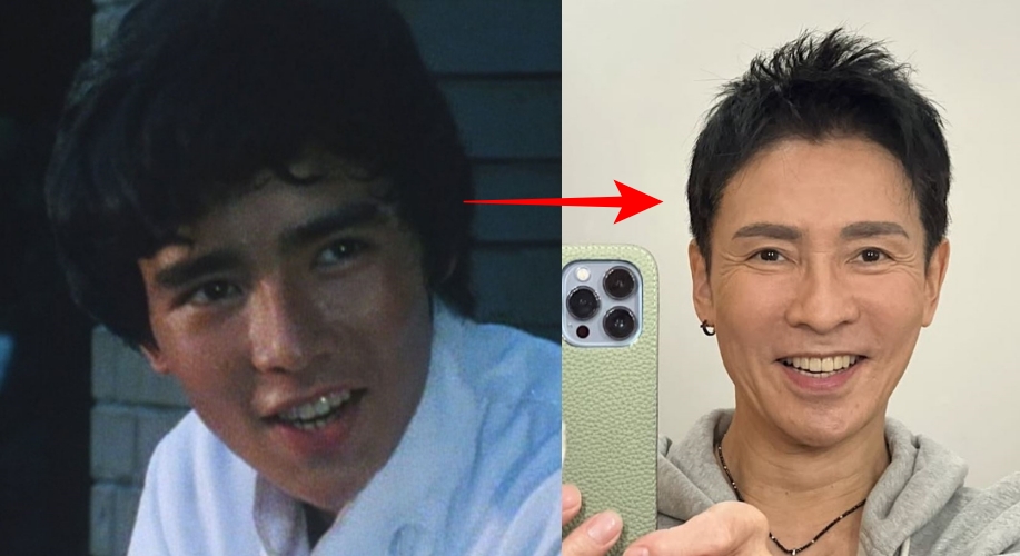 郷ひろみの若い頃と現在