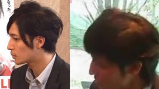 玉木宏の頭頂部画像